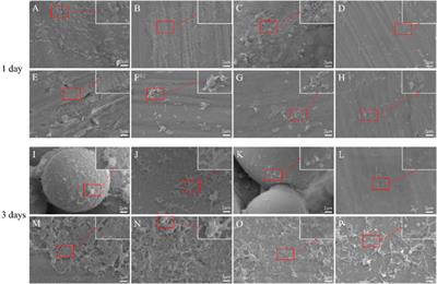 Antibacterial performance of a porous Cu-bearing titanium alloy by laser additive manufacturing